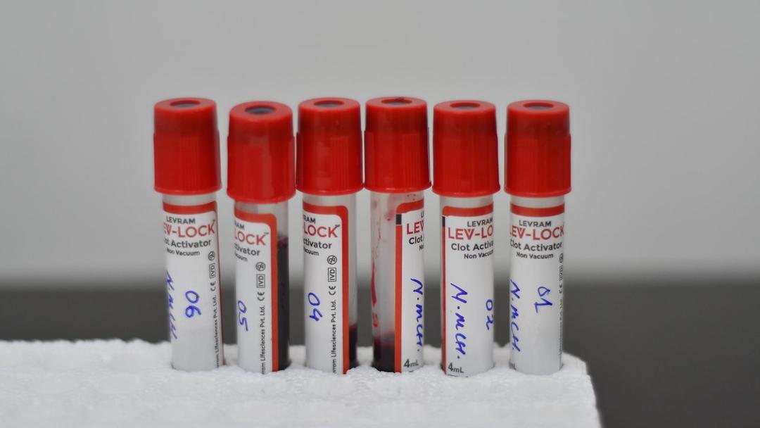 Study: Blood Test Detects Cancer 3 Years Before Diagnosis