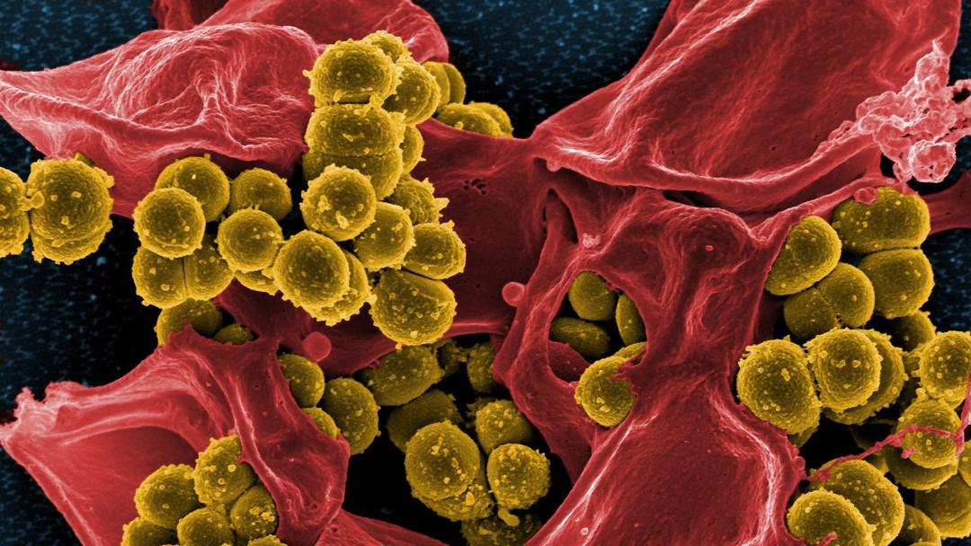 MIT Uses AI to Design Antibiotics Against Superbugs