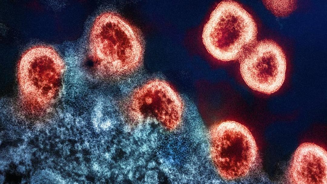 'Oslo Patient' Achieves Long-Term HIV Remission