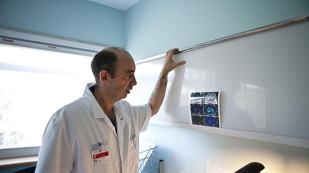 Study: Blood Test Detected 90% of Aggressive Prostate Cancers
