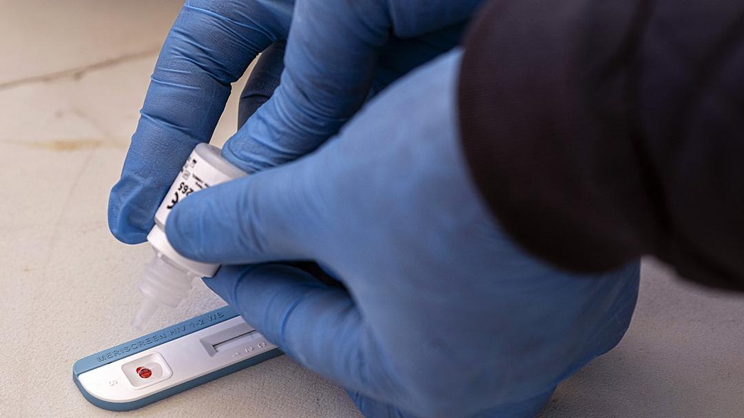 Report: US Funding Cuts Impeding Global HIV Treatment
