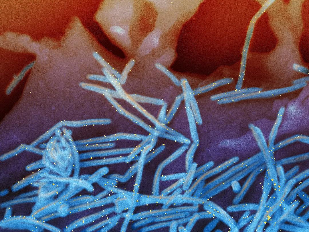 CDC Warns of Another 'Tripledemic' This Winter