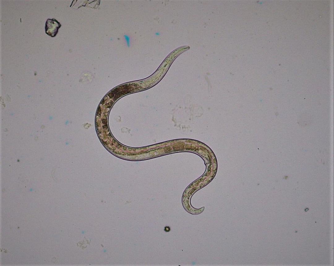 Live Roundworm Found in Australian Woman's Brain
